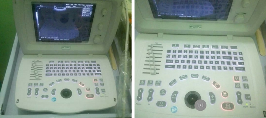 أحدث جهاز طبي بعيادة الباطنة والاطفال